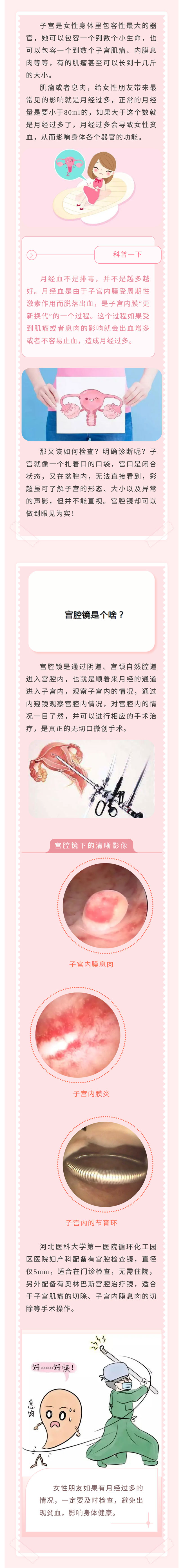 月經(jīng)量增多！怎么回事？——小小“宮腔鏡”，一探究竟！.jpg